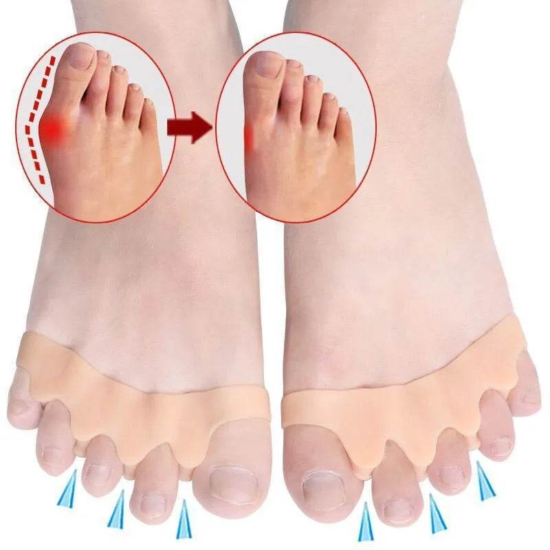 CozyStep™ Toe Separator: Say Goodbye to Hallux Valgus! - Montero Milan